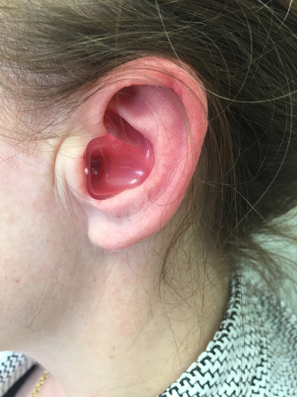 Ear Plugs Dr Bridget Clancy | Surgeon